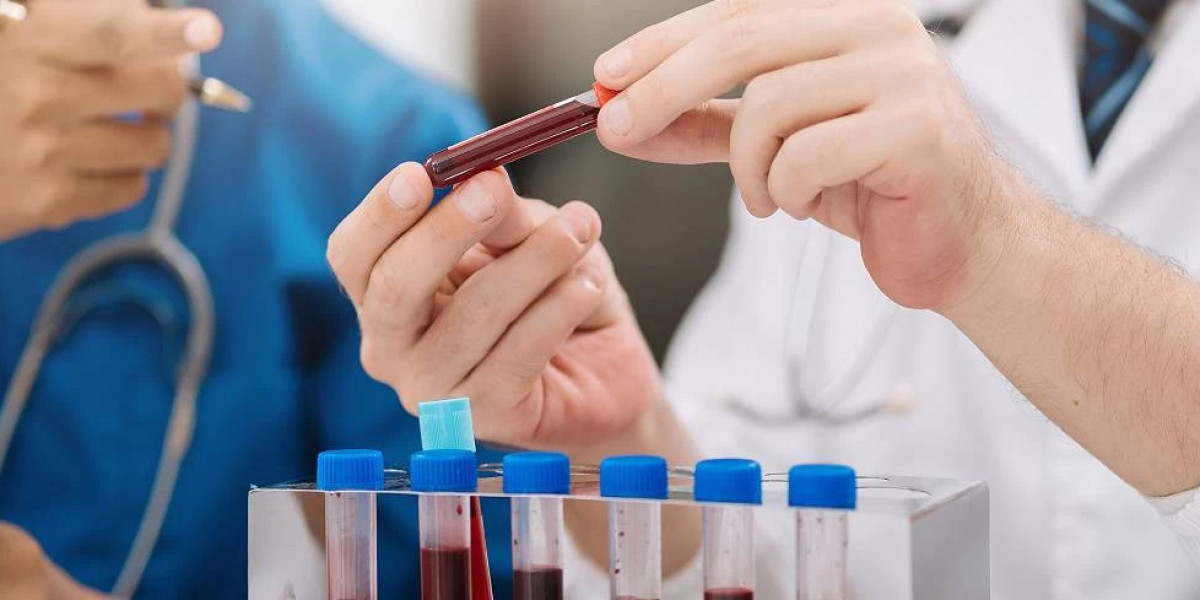 Blood Test at Home: Common Tests You Can Do Without Visiting a Lab
