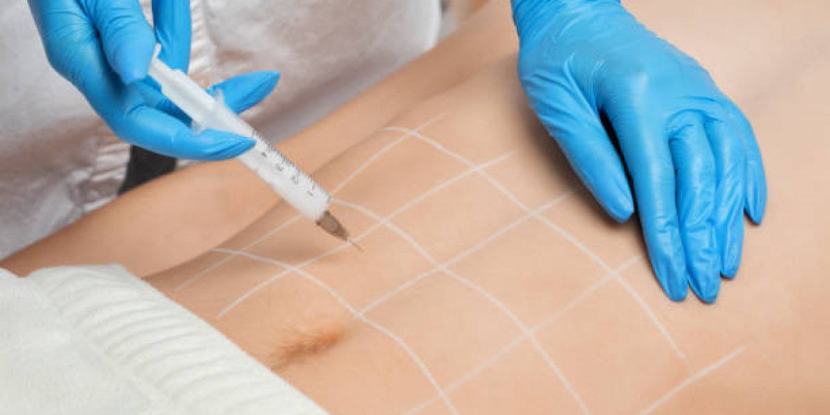 Men’s Guide to Gynecomastia Surgery in Riyadh
