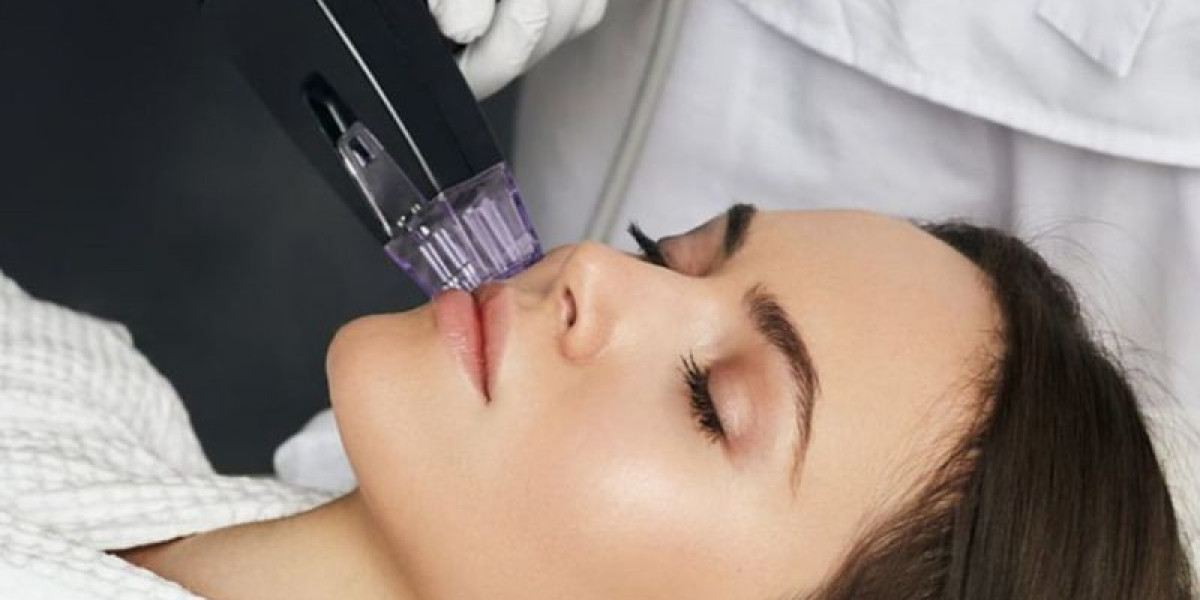 Can Morpheus8 in Dubai reduce scars?
