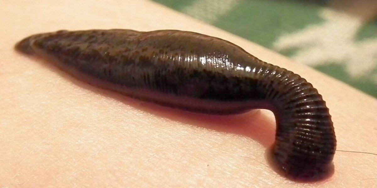 Mumbai’s Rising Demand for Medicinal Leech Therapy in 2025
