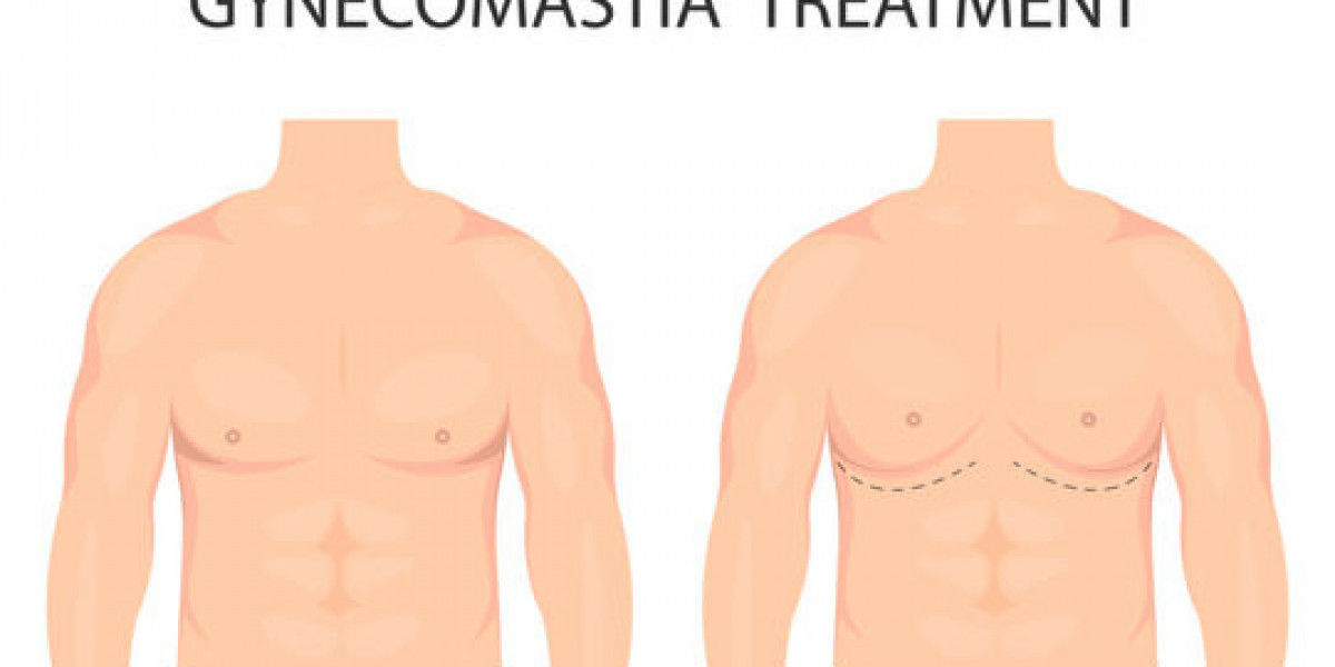 Local vs general anesthesia in gynecomastia surgery in Islamabad