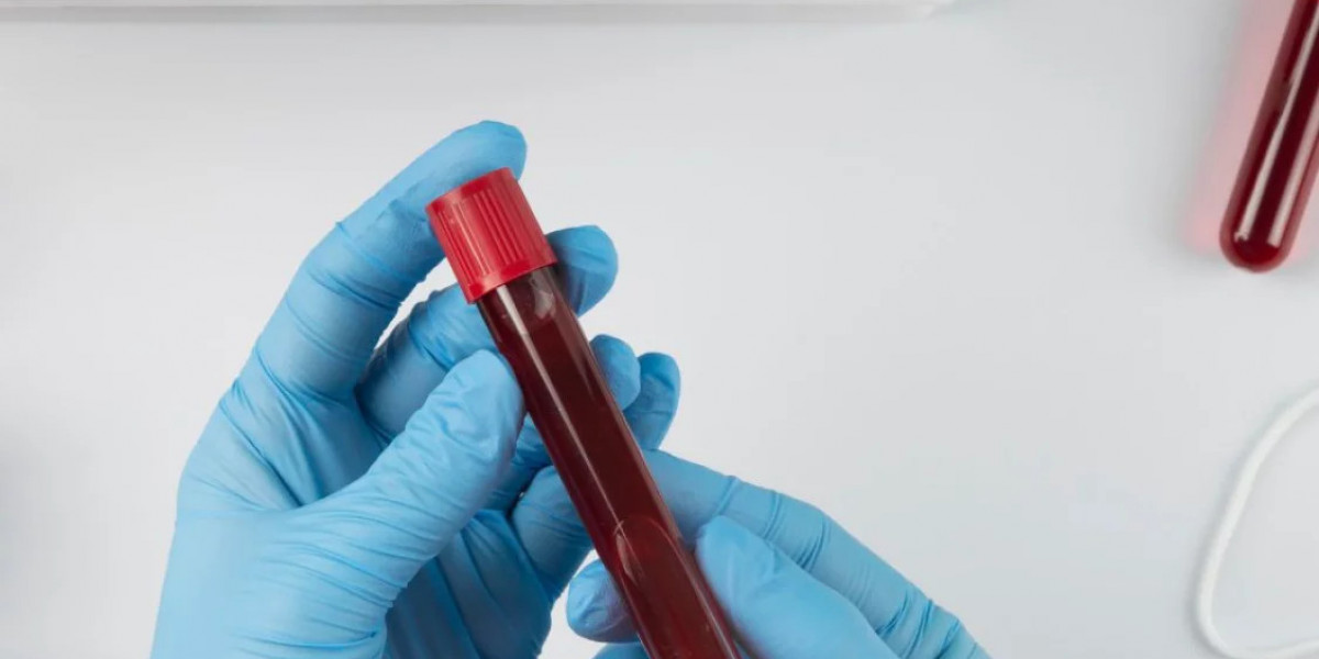 Blood Test at Home: Ensuring Quality Samples