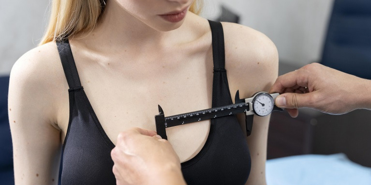 How to Choose the Right Clinic for Breast Reduction Surgery in Riyadh