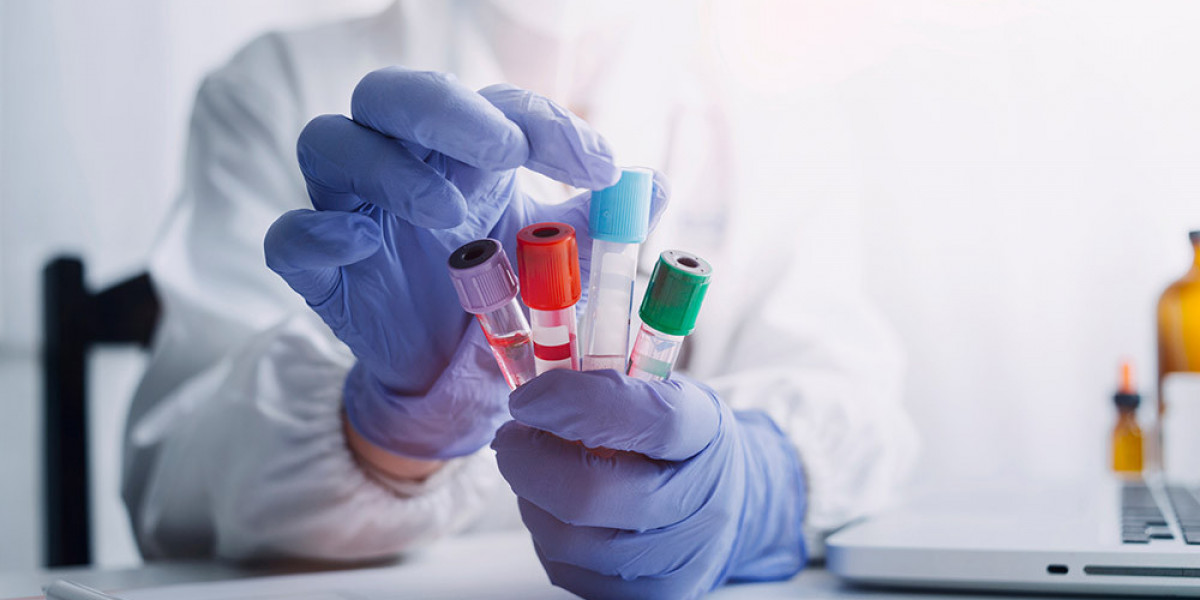 Blood Test at Home: Fast Results for Better Health Decisions