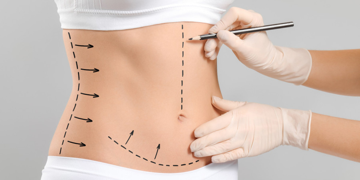 Tummy Tuck Recovery Timeline in Islamabad