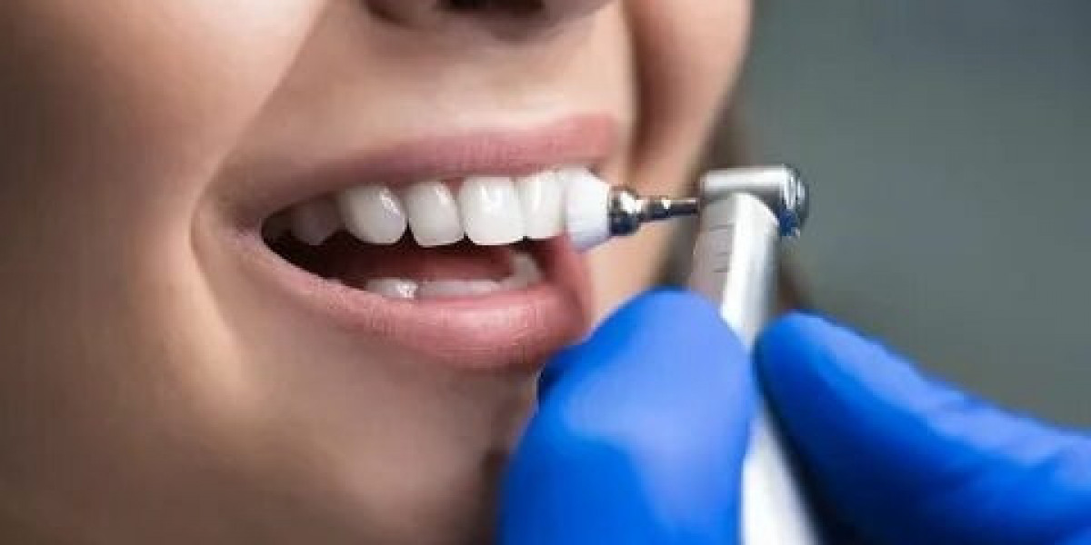 Myths and Facts About Teeth Cleaning and Polishing in Islamabad