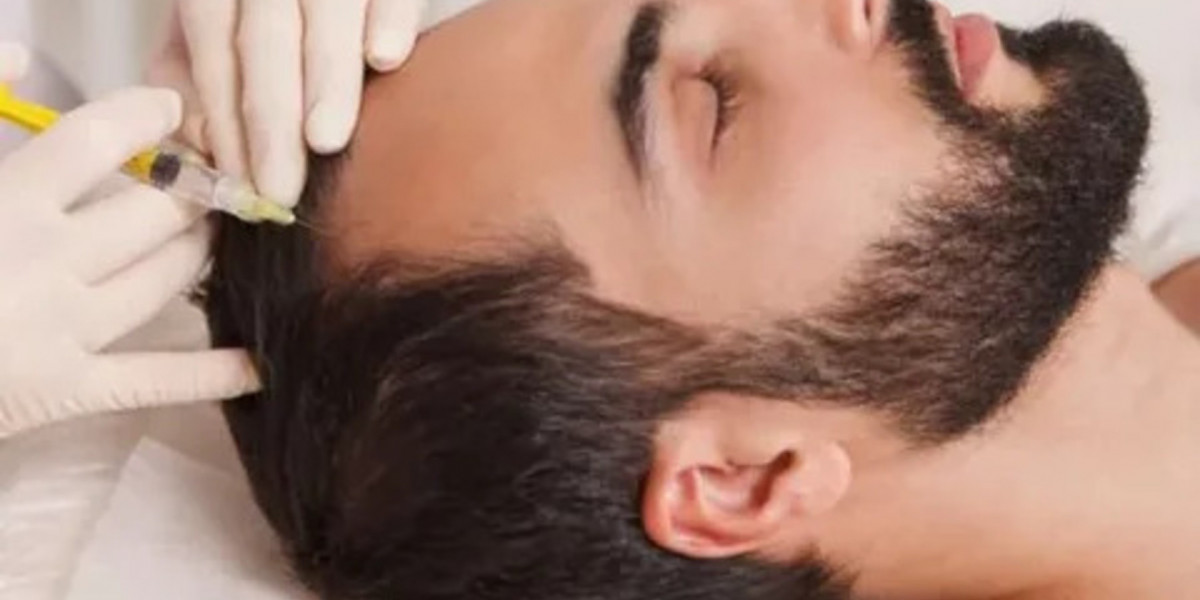 PRP Hair Treatment in Islamabad with Experienced Doctors