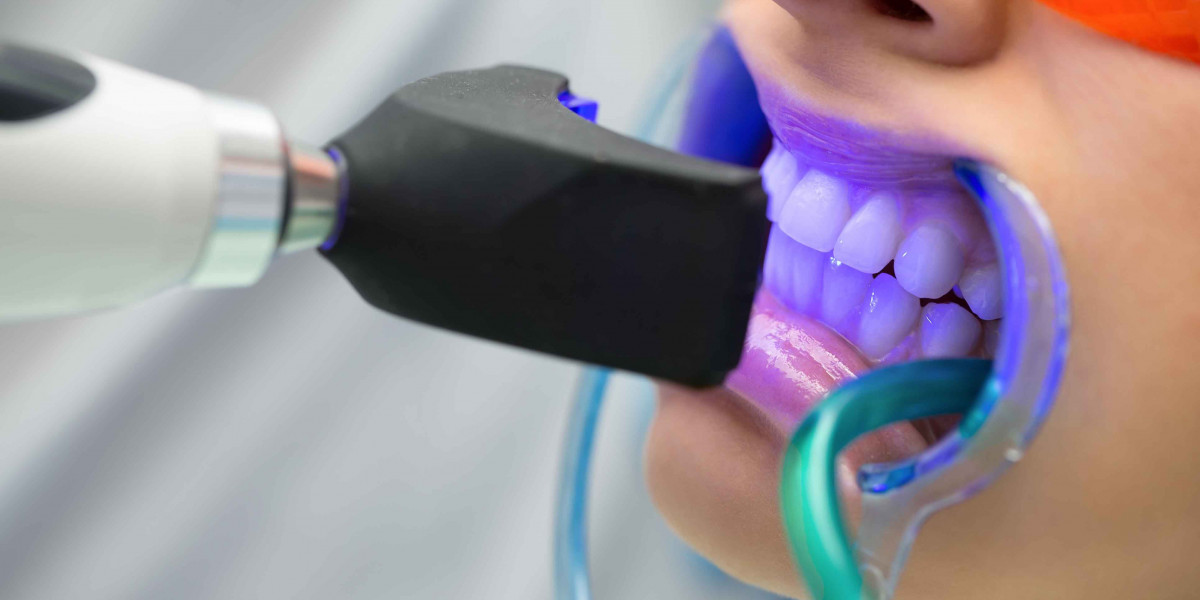 Emergency Teeth Whitening Options in Islamabad