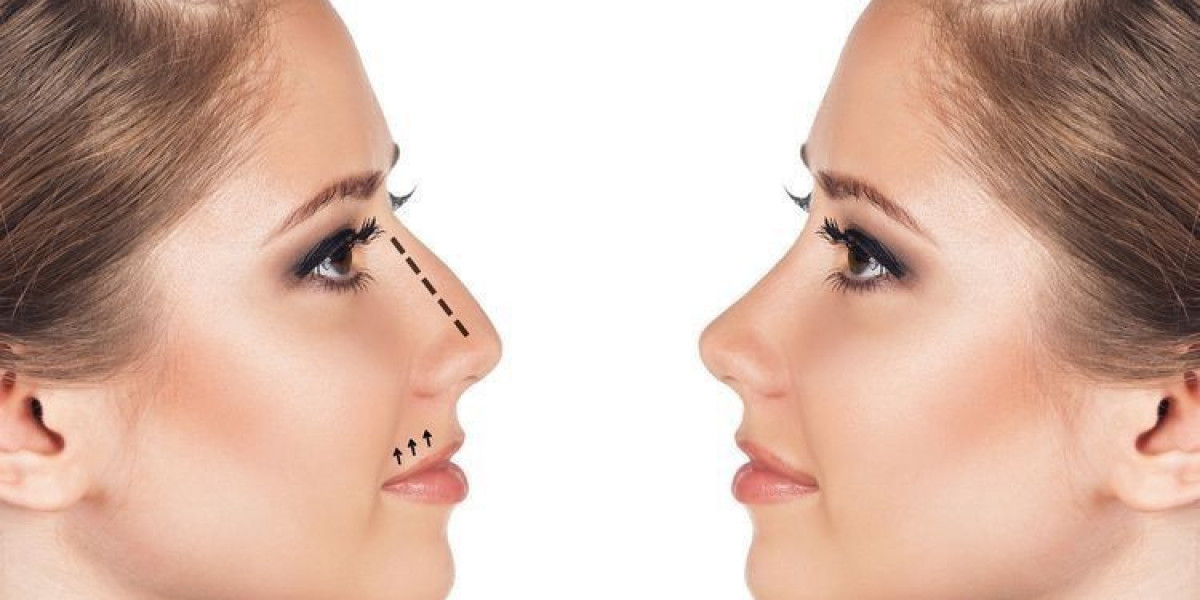 Nose Surgery for Breathing Improvement in Riyadh