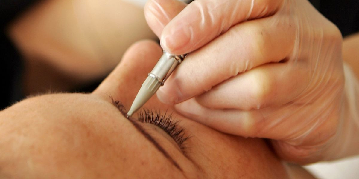 How Electrolysis Cost Varies