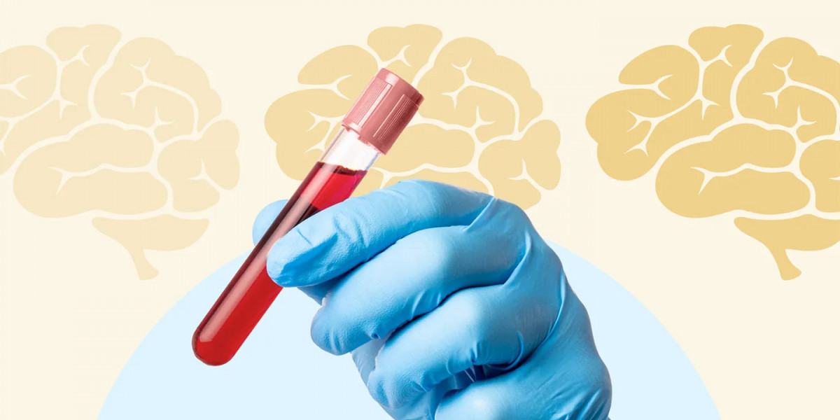 Blood Test at Home to Optimize Brain Health