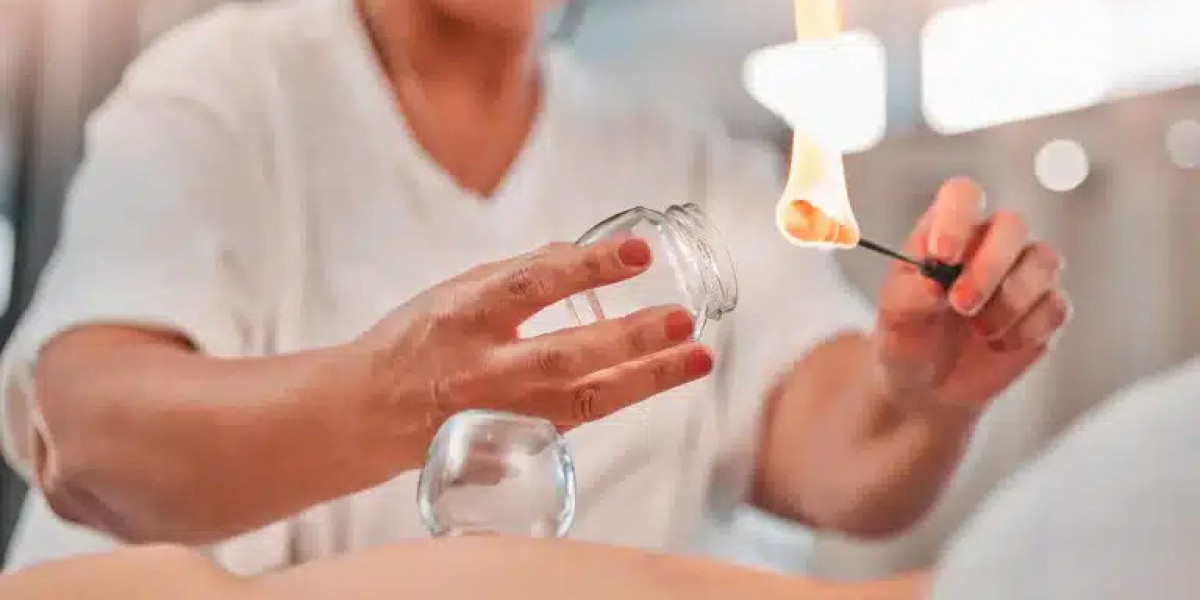 Hijama Treatment for Stress and Anxiety Relief