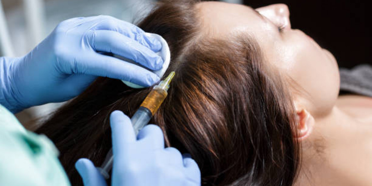 PRP Hair Treatment: How It Boosts Hair Growth Naturally