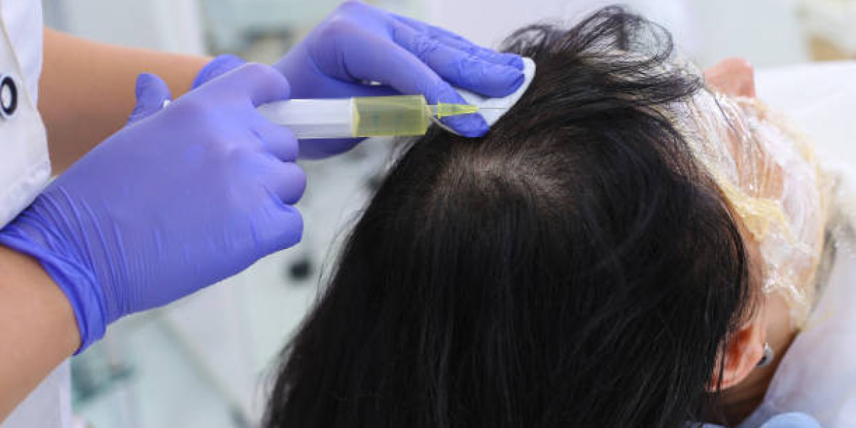 Riyadh PRP: Your Own Blood for Fuller Hair