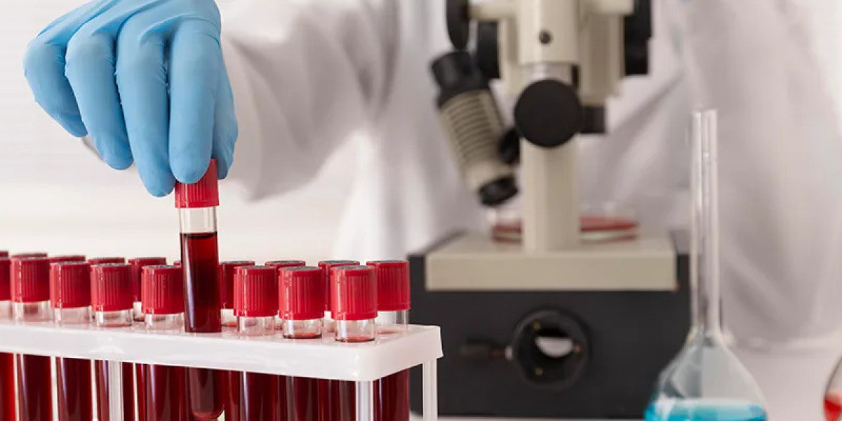 Stay Ahead of Infections with a Timely Blood Sugar Test