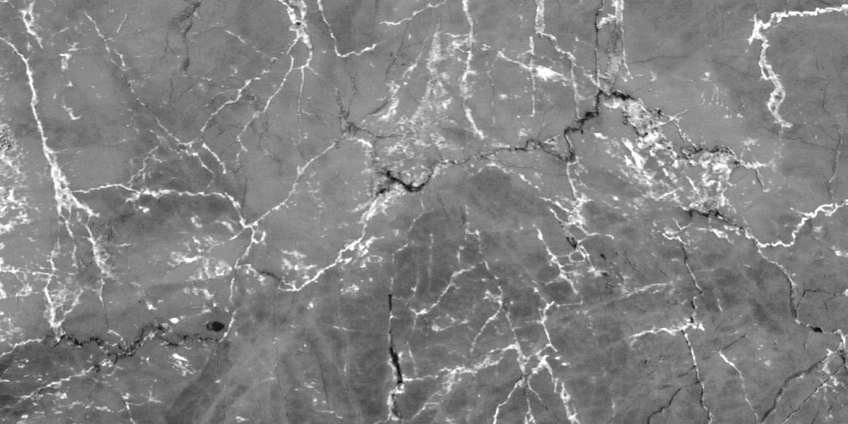 Erectile Dysfunction Treatment For Younger Males: A Case Examine