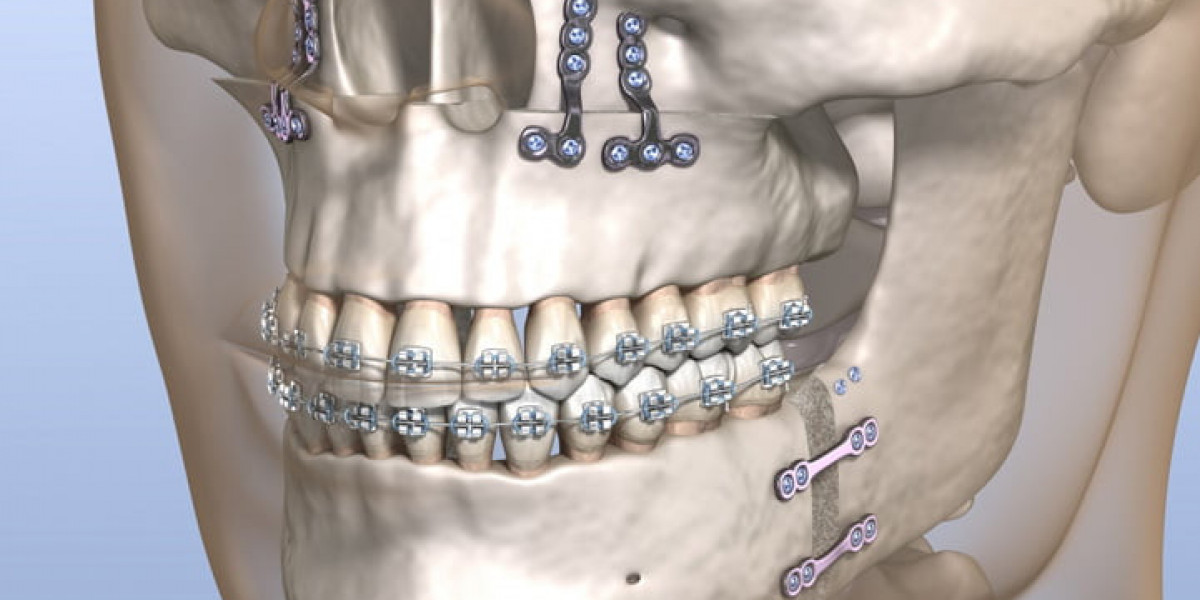 Post-Surgery Care Tips for Faster Healing in Islamabad