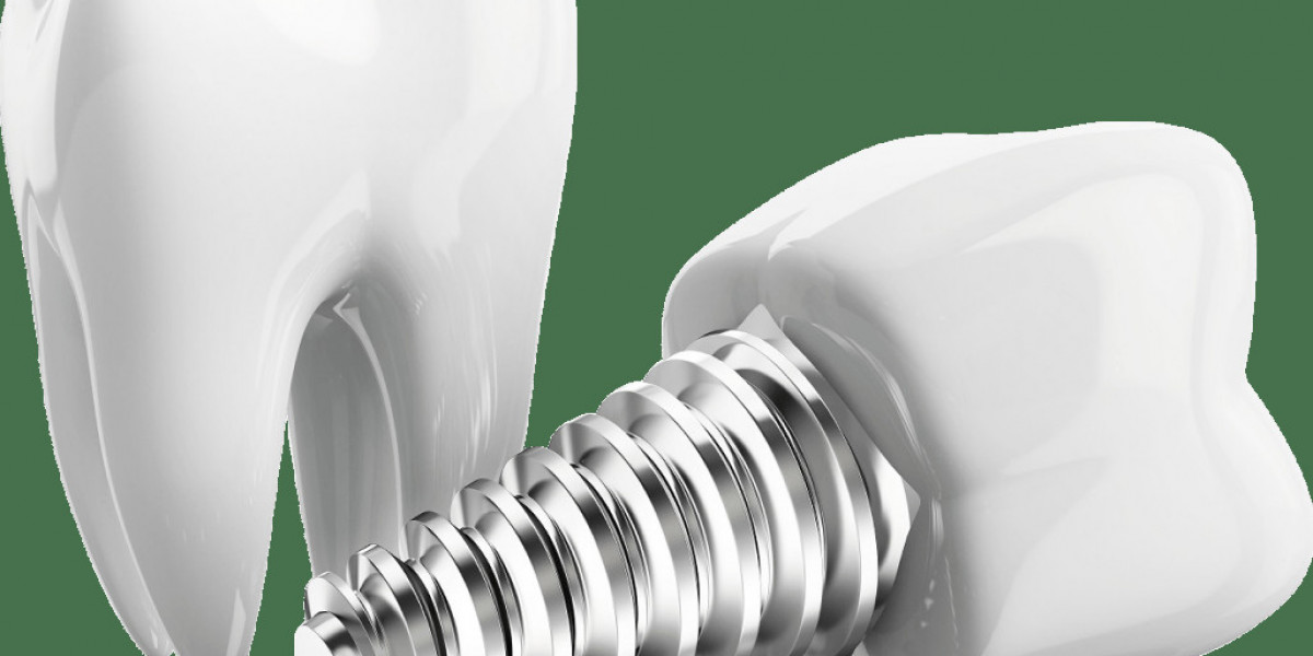 Why Visiting a Dental Implants Clinic in F7 Is the Best Solution for Missing Teeth