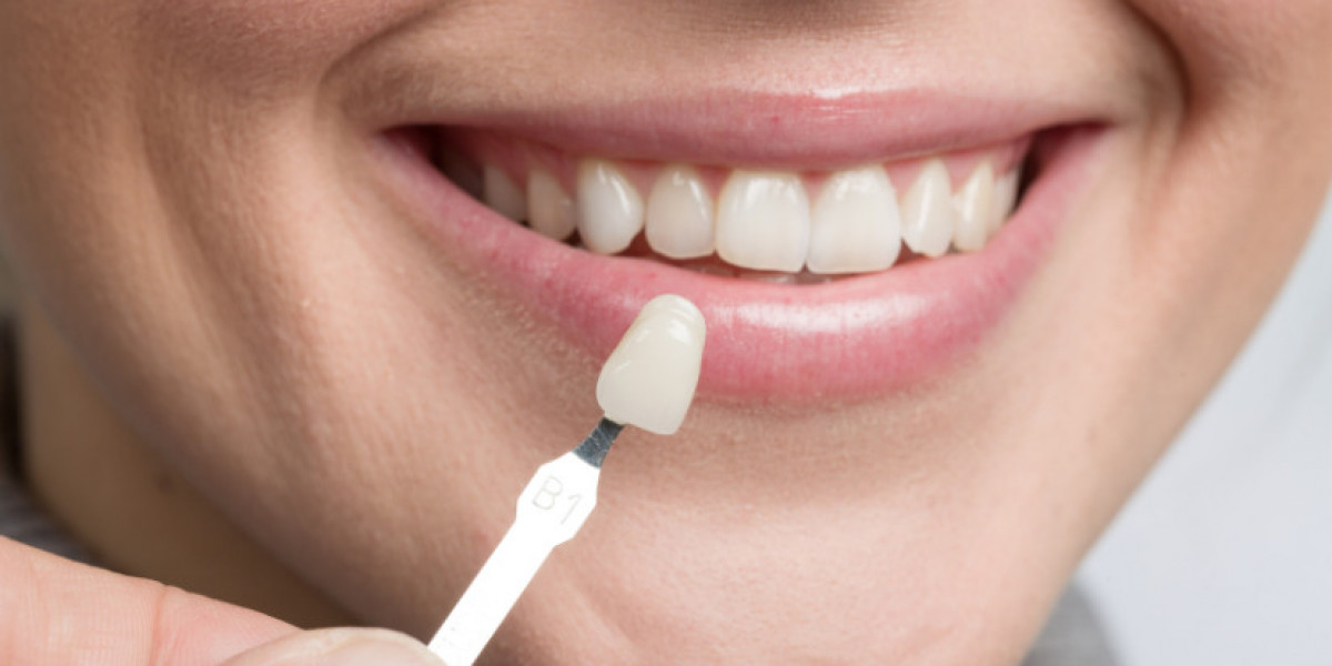 Achieve a Confident Smile with Dental Veneers in Islamabad