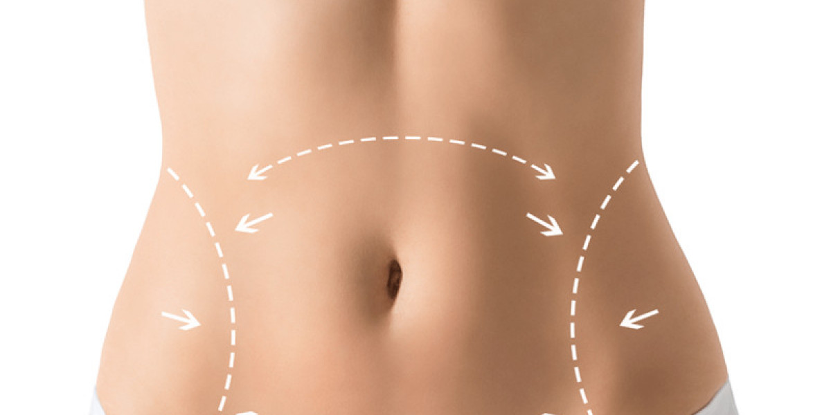 Reclaim Your Pre-Pregnancy Shape | Expert Tummy Tuck