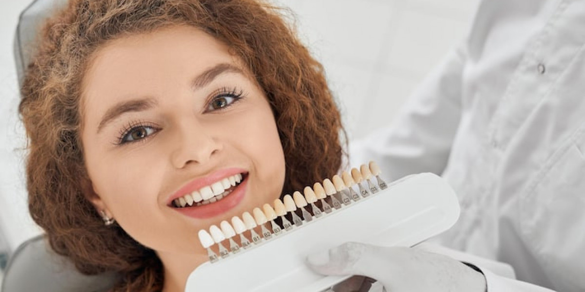 Dental Veneers Cost That Make Smiles Look Natural, Bright, and Balanced