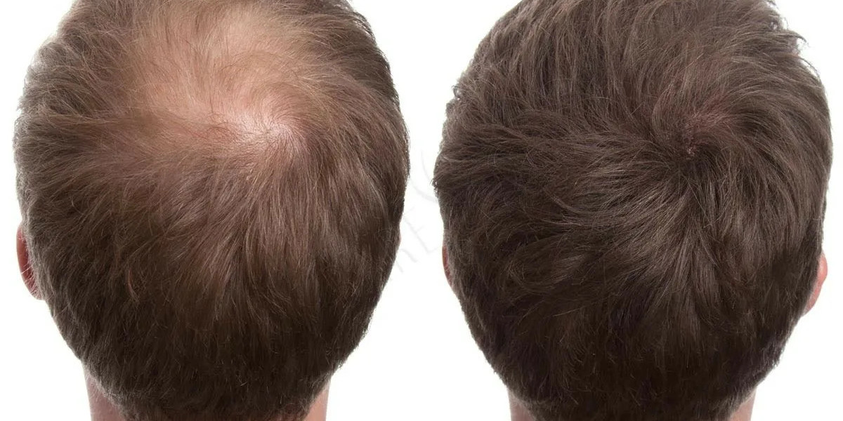 Exosomes and the Future of Personalized Healthcare