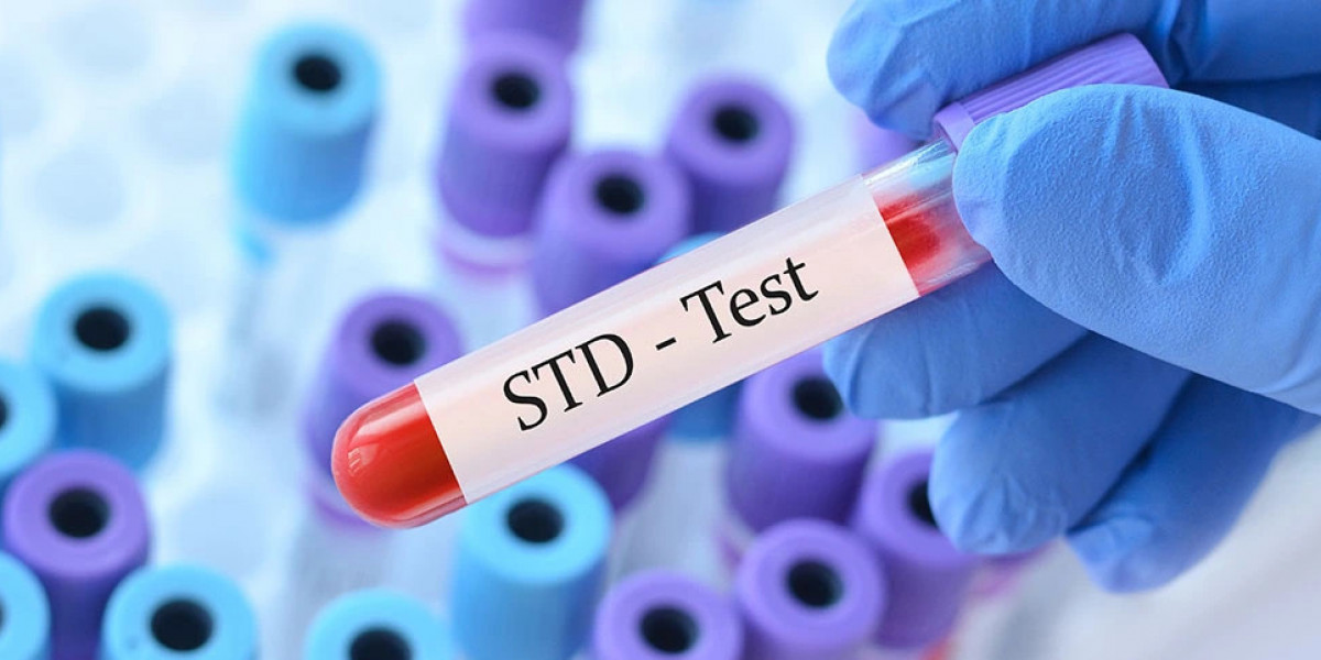 How an STD Test Helps Stop the Spread of Infections