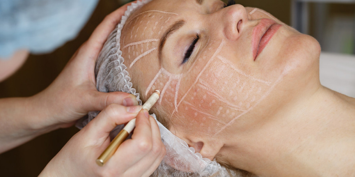 Targeted Facelift Surgery for Specific Concerns