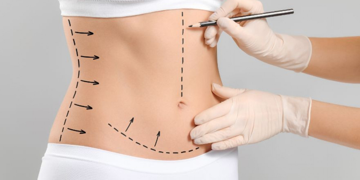 Tummy Tuck in Dubai for a Sleek and Naturally Slim Stomach