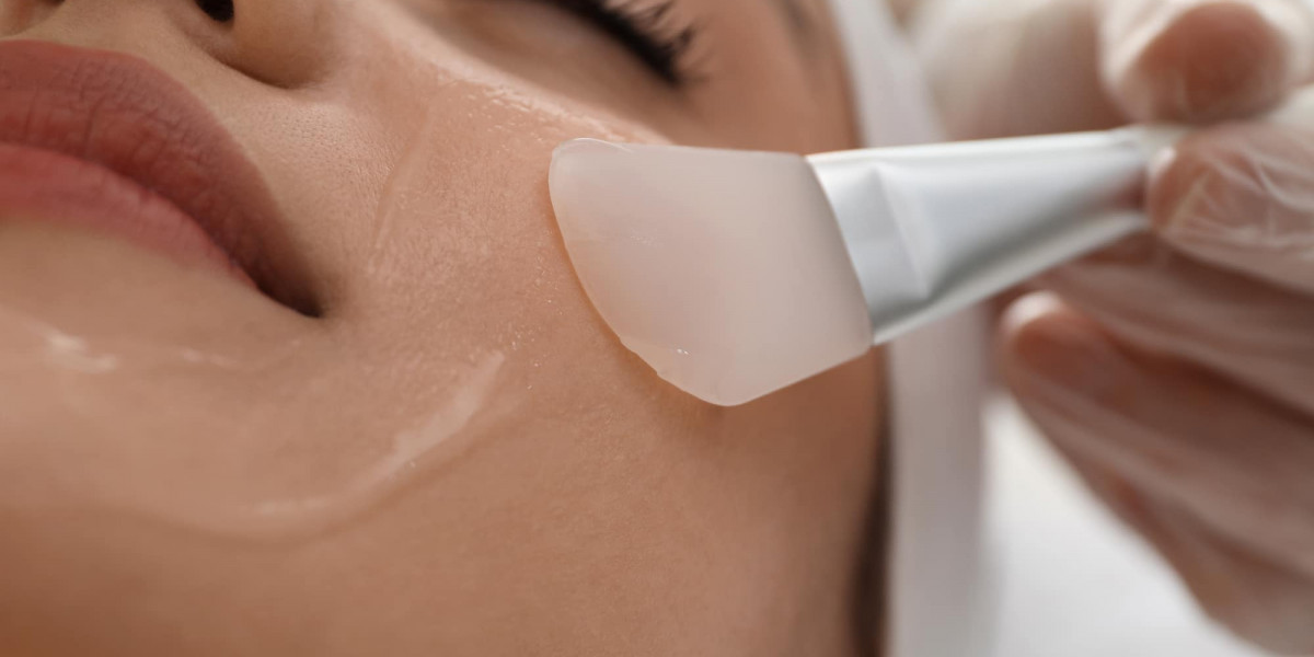 Can Superficial Chemical Peels Improve Pigmentation?