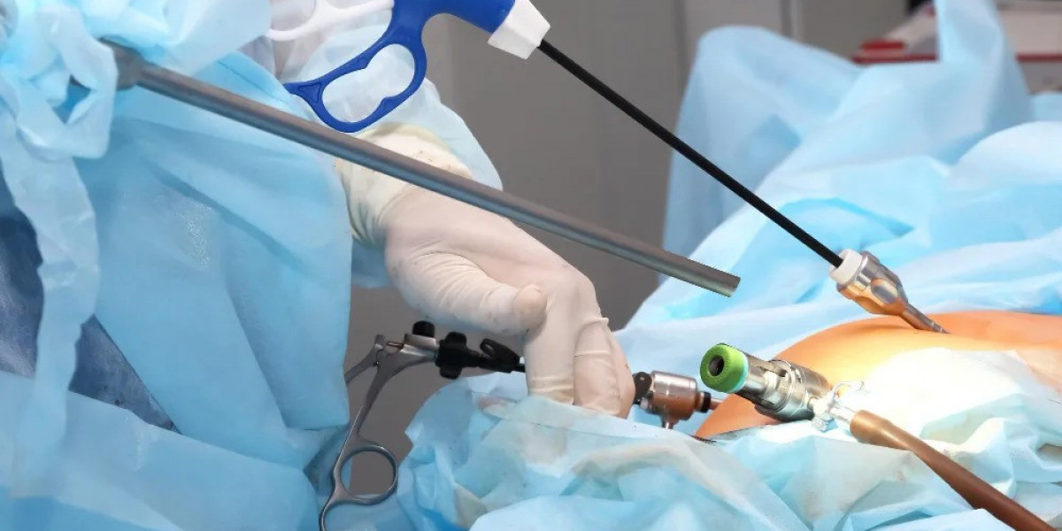 Why Laparoscopic Surgery is Preferred for Many Patients