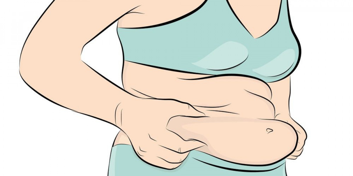 Abdominoplasty in Islamabad