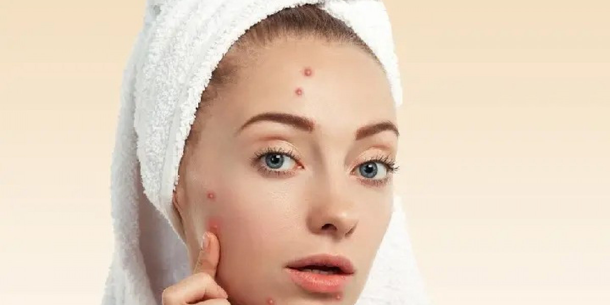 Erase the Marks of Acne