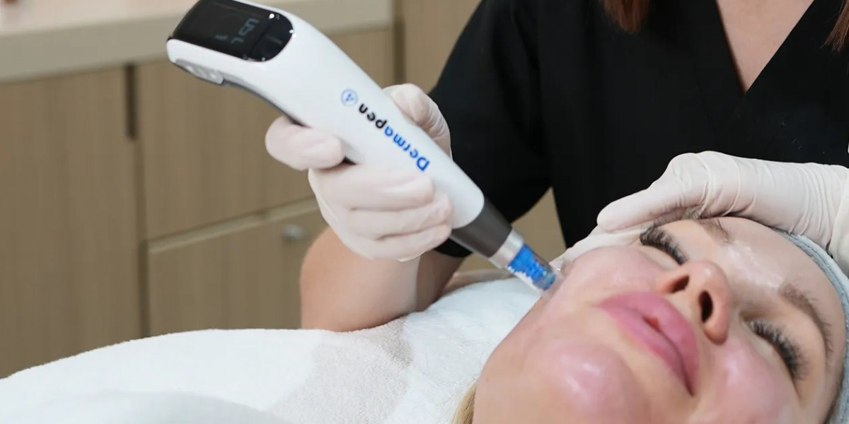 Hair Fall Treatment with Mesotherapy in Islamabad