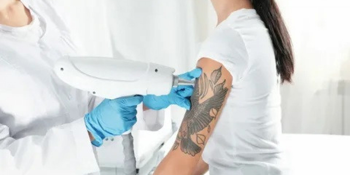 Tattoo Removal for Faded Ink: Islamabad Clinics
