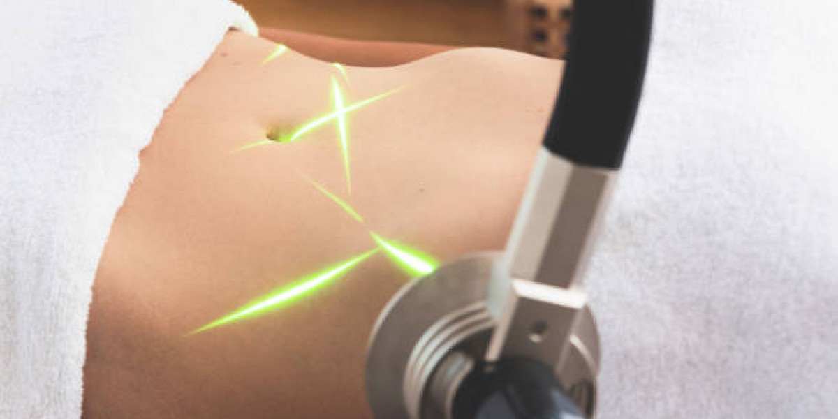 علاج شفط الدهون بالليزر في الرياض نتائج طبيعية