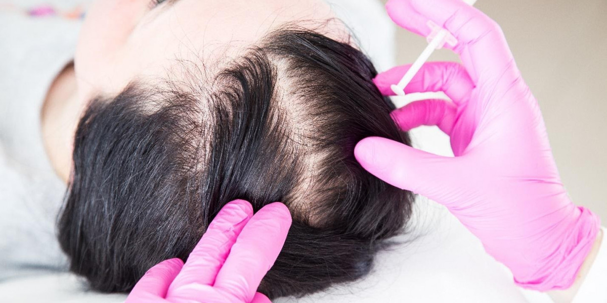 Best Hair Loss Treatment in Islamabad – Restore Your Hair at Enfeild Royal Clinic in Islamabad.