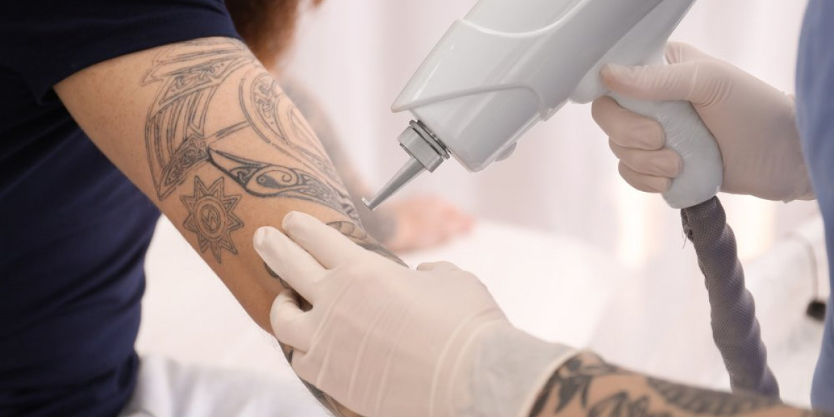 Sun exposure and its impact on tattoo removal results