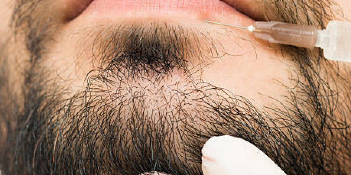 Beard Hair Transplant: Achieving Natural and Permanent Beard Growth