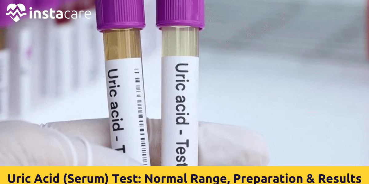 Purpose of a Uric Acid Test: Why This Blood Test Is Important for Monitoring Health and Detecting Early Signs of Disease