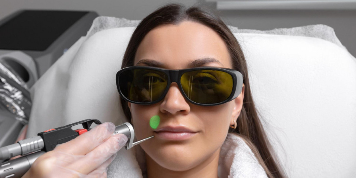 Co2 Laser In Manchester – Resurface Your Skin for a Youthful Appearance