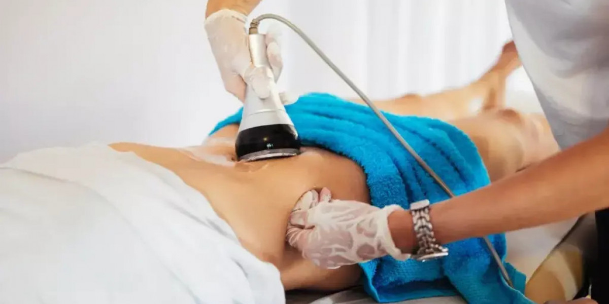 Laser Fat Reduction for Women: A Complete Overview