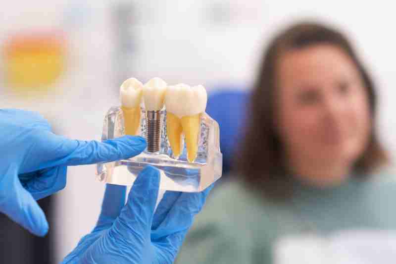 Why Single Tooth Implants Prevent Bigger Future Procedures