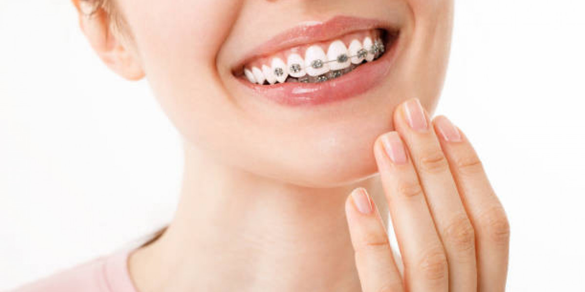 A Reliable Solution for Correcting Dental Alignment Teeth Braces in Islamabad: