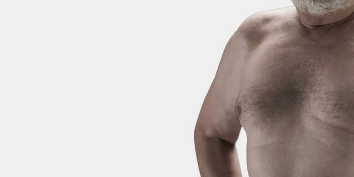 Understanding the Benefits of Gynecomastia Surgery for Men