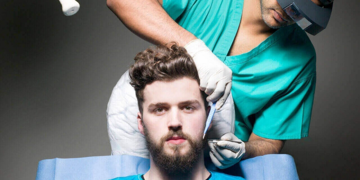 Beard hair transplant in Riyadh lifestyle changes before procedure