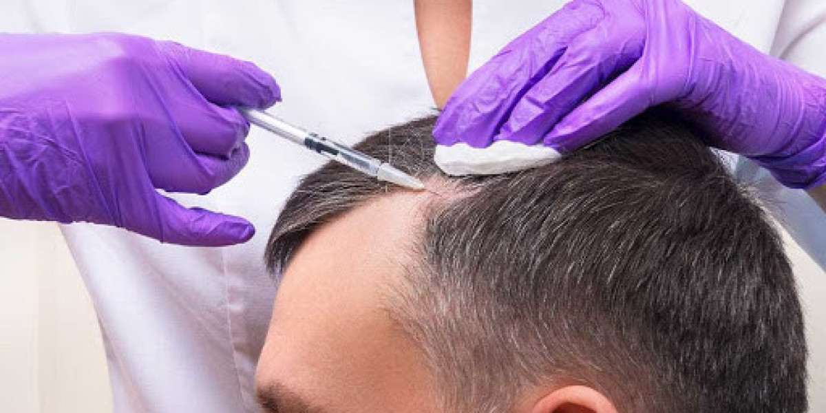 Exosome Hair Therapy: Understanding Treatment and Recovery